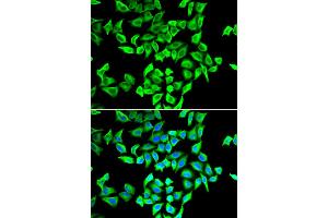 Immunofluorescence analysis of A549 cells using TP53 antibody (ABIN5970093). (p53 antibody)
