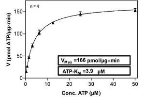 Image no. 2 for Protein Kinase C, theta (PRKCQ) (AA 1-706) (Active) protein (GST tag) (ABIN5570620) (PKC theta Protein (AA 1-706) (GST tag))
