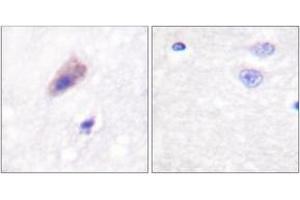 Immunohistochemistry analysis of paraffin-embedded human brain, using Dynamin-1 (Phospho-Ser774) Antibody. (Dynamin 1 antibody  (pSer774))