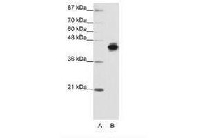 Image no. 1 for anti-Keratin 18 (KRT18) (N-Term) antibody (ABIN203131) (Cytokeratin 18 antibody  (N-Term))