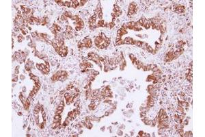 Image no. 1 for anti-NudC Domain Containing 1 (NUDCD1) (AA 332-583) antibody (ABIN1499850) (NUDCD1 antibody  (AA 332-583))