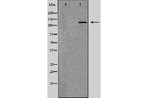 Western blot analysis of Mouse spleen lysate, using ITGAM Antibody. (CD11b antibody  (Internal Region))