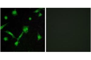Immunofluorescence analysis of LOVO cells, using IkappaB-alpha (Phospho-Ser32/Ser36) Antibody. (NFKBIA antibody  (pSer32))
