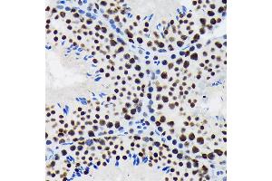 Immunohistochemistry (IHC) image for anti-Splicing Factor 3b, Subunit 1, 155kDa (SF3B1) antibody (ABIN7270542)