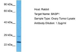 Host: Rabbit Target Name: BASP1 Sample Tissue: Human Ovary Tumor Antibody Dilution: 1ug/ml (BASP1 antibody  (N-Term))