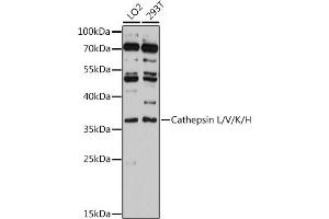 Western blot analysis of extracts of various cell lines, using Cathepsin L/V/K/H antibody (ABIN6127670, ABIN6139235, ABIN6139237 and ABIN6215636) at 1:3000 dilution. (Cathepsin L antibody  (AA 114-333))