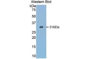 Western blot analysis of recombinant Mouse TOLLIP. (TOLLIP antibody  (AA 19-254))