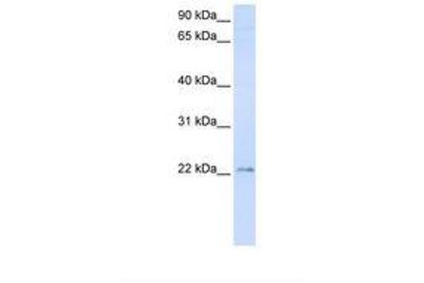 TMEM9 antibody  (C-Term)