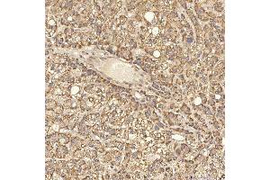 IHC analysis of RBMS1 using anti-RBMS1 antibody (ABIN7601195).