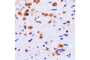 Immunohistochemical analysis of CUGBP1 staining in human brain formalin fixed paraffin embedded tissue section. (CELF1 antibody  (Center))