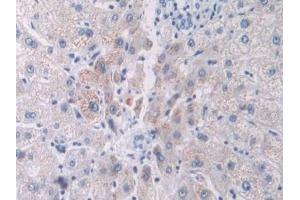 Detection of PCOLCE in Human Liver Tissue using Polyclonal Antibody to Procollagen C-Endopeptidase Enhancer (PCOLCE) (PCOLCE antibody  (AA 315-437))