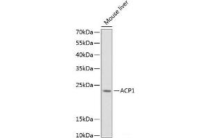 Western blot analysis of extracts of Mouse liver using ACP1 Polyclonal Antibody at dilution of 1:1000. (ACP1 antibody)