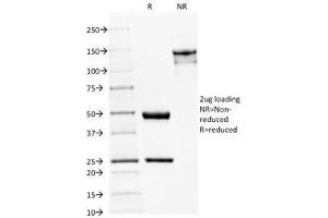 SDS-PAGE Analysis of Purified, BSA-Free Spectrin beta III Antibody (clone SPTBN2/1582). (Spectrin, Beta, Non-erythrocytic 2 (SPTBN2) (AA 356-475) antibody)