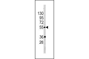 GOPC Antikörper  (AA 164-193)