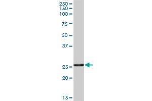 CTRB1 MaxPab polyclonal antibody. (CTRB1 antibody  (AA 1-263))