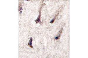 Formalin-fixed and paraffin-embedded human brain tissue reacted with PKC beta2 antibody (C-term), which was peroxidase-conjugated to the secondary antibody, followed by DAB staining. (PKC beta antibody  (C-Term))