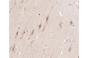 ABIN6266602 at 1/100 staining human brain tissue sections by IHC-P. (ENO2/NSE antibody  (C-Term))