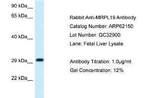 Western Blotting (WB) image for anti-Mitochondrial Ribosomal Protein L19 (MRPL19) (C-Term) antibody (ABIN2774335) (MRPL19 antibody  (C-Term))