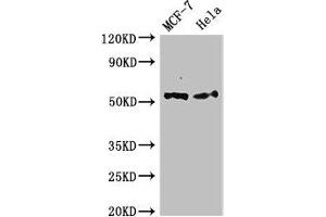 Western Blot Positive WB detected in: MCF-7 whole cell lysate, Hela whole cell lysate All lanes: PTK6 antibody at 2. (PTK6 antibody  (AA 1-113))