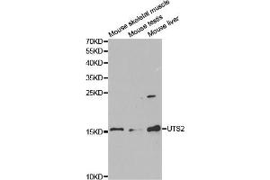 Western blot analysis of extracts of various cell lines, using UTS2 antibody (ABIN5973072) at 1/1000 dilution. (Urotensin 2 antibody)
