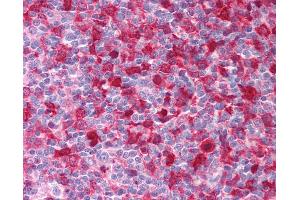 Anti-SYK antibody IHC of human tonsil. (SYK antibody  (AA 5-360))