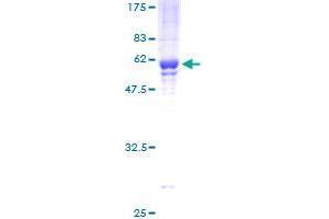 BRMS1 Protein (AA 1-246) (GST tag)