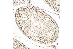 Immunohistochemistry of paraffin embedded rat testis using SCP1 (ABIN7075786) at dilution of 1:500 (300x lens) (SYCP1 antibody)