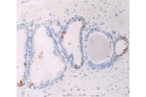 IHC-P analysis of Human Prostate Gland Tissue, with DAB staining. (GREM1 antibody  (AA 26-184))