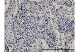 Immunoperoxidase of monoclonal antibody to TPSAB1 on formalin-fixed paraffin-embedded human lymph node. (TPSAB1 antibody  (AA 1-275))