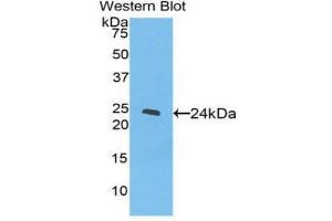 Western Blotting (WB) image for anti-Peroxisome Proliferator-Activated Receptor gamma (PPARG) (AA 311-500) antibody (ABIN1860282)