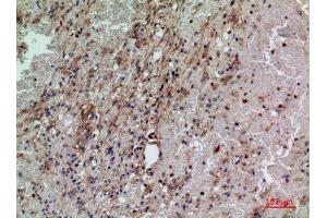 Immunohistochemistry (IHC) analysis of paraffin-embedded Human Brain, antibody was diluted at 1:100.