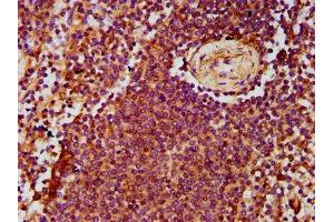 IHC image of ABIN7143386 diluted at 1:500 and staining in paraffin-embedded human spleen tissue performed on a Leica BondTM system.