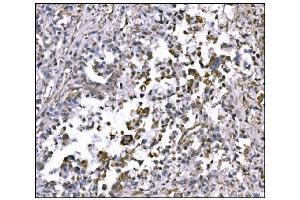 IHC analysis of NDEL1 using anti-NDEL1 antibody (ABIN7602511).