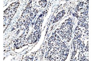 IHC analysis of DLX2 using anti-DLX2 antibody (ABIN7599936). (DLX2 antibody  (AA 13-310))