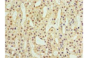 Immunohistochemistry of paraffin-embedded human adrenal gland tissue using ABIN7144559 at dilution of 1:100 (ADAP1 antibody  (AA 1-374))