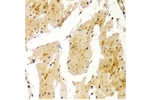 Immunohistochemistry of paraffin-embedded Human esophageal using MVP antibody at dilution of 1:100 (x400 lens). (MVP antibody  (AA 1-260))