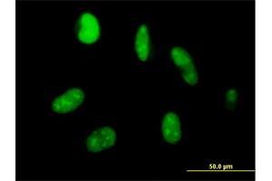 Immunofluorescence of purified MaxPab antibody to ZNF331 on HeLa cell. (ZNF331 antibody  (AA 1-463))