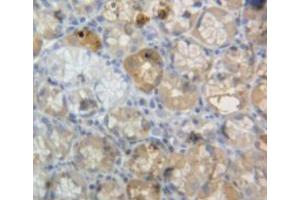 Used in DAB staining on fromalin fixed paraffin-embedded stomach tissue (Neuromedin U antibody  (AA 35-158))