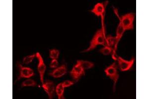 ABIN6274912 staining HuvEc by IF/ICC. (B4GALT5 antibody  (C-Term))