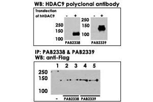 Both HDAC9  and HDAC9  polyclonal antibody were tested by WB and IP-WB using HeLa and HeLa-HDAC9 transfected cells. (HDAC9 antibody  (N-Term))
