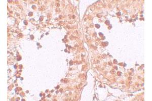 Immunohistochemical staining of human testis cells with CRISP2 polyclonal antibody  at 10 ug/mL. (CRISP2 antibody  (N-Term))
