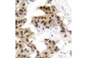 Immunohistochemistry (IHC) image for anti-Nuclear Factor of kappa Light Polypeptide Gene Enhancer in B-Cells 1 (NFKB1) (pSer893) antibody (ABIN1870468) (NFKB1 antibody  (pSer893))