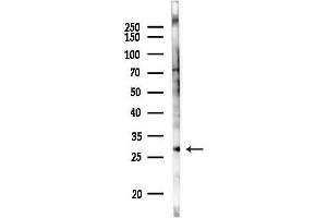 Western blot analysis of lysates from Rat brain, using RA Antibody at 1/1000 dilution.