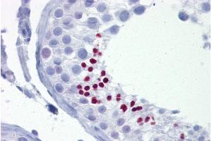 Immunohistochemistry with Testis tissue at an antibody concentration of 5µg/ml using anti-TLE4 antibody (ARP32381_P050) (TLE4 antibody  (N-Term))