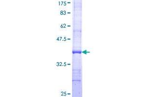 Factor VIII Protein (AA 213-312) (GST tag)