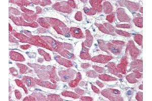 Heart, Human: Formalin-Fixed, Paraffin-Embedded (FFPE) (CRYAB antibody  (C-Term))