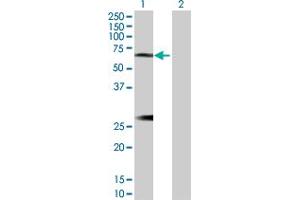 Western Blot analysis of IL6R expression in transfected 293T cell line by IL6R MaxPab polyclonal antibody.