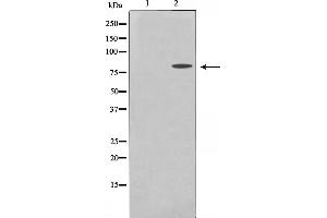 Western blot analysis on MDA-MB-435 cell lysate using MMP15 Antibody. (MMP15 antibody  (C-Term))