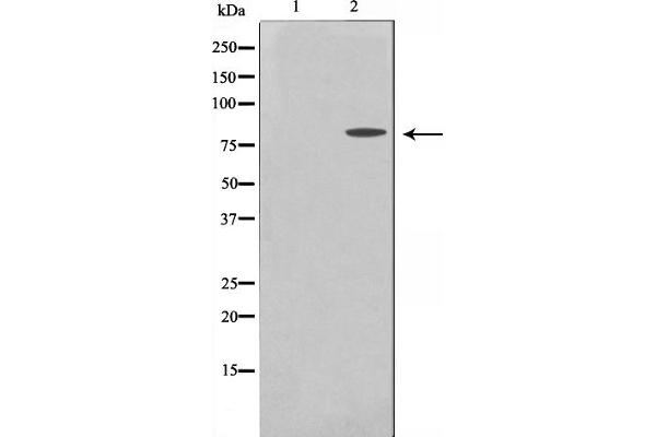 MMP15 anticorps  (C-Term)