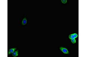 Immunofluorescent analysis of HepG2 cells using ABIN7157938 at dilution of 1:100 and Alexa Fluor 488-congugated AffiniPure Goat Anti-Rabbit IgG(H+L) (LTBP4 antibody  (AA 977-1180))